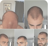 Rollon CRECE MAX ROMERO Estimula el crecimiento de tu Cabello con el efecto del Romero + Envio Gratis 🎁