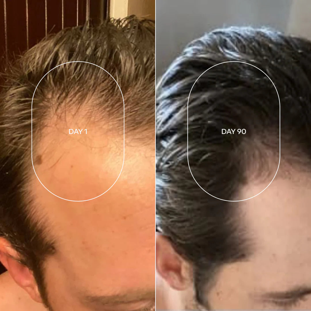 Rollon CRECE MAX ROMERO Estimula el crecimiento de tu Cabello con el efecto del Romero + Envio Gratis 🎁